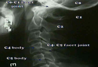 X-Rays
